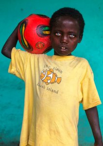 inspiringlife.pt - Doença Genética Rara faz com que Este Menino tenha Olhos Incríveis!