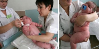 Mulher deu à luz o maior bebé do mundo com 18kg