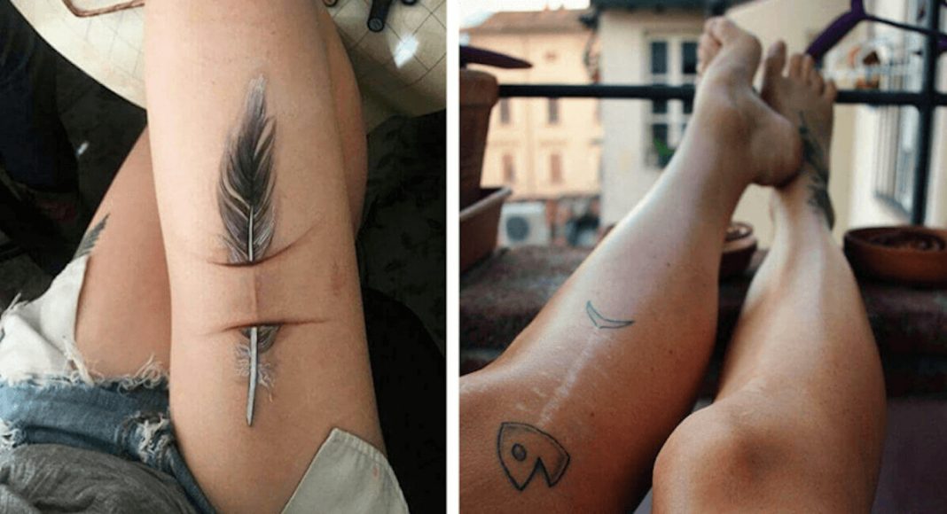 21 incríveis tatuagens que transformaram cicatrizes em belíssimas obras-de-arte