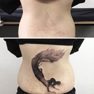 inspiringlife.pt - 21 incríveis tatuagens que transformaram cicatrizes em belíssimas obras-de-arte