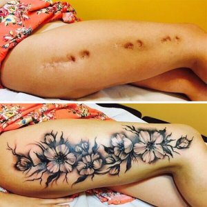 inspiringlife.pt - 21 incríveis tatuagens que transformaram cicatrizes em belíssimas obras-de-arte