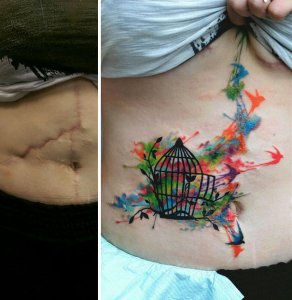 inspiringlife.pt - 21 incríveis tatuagens que transformaram cicatrizes em belíssimas obras-de-arte