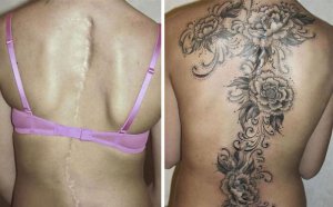 inspiringlife.pt - 21 incríveis tatuagens que transformaram cicatrizes em belíssimas obras-de-arte