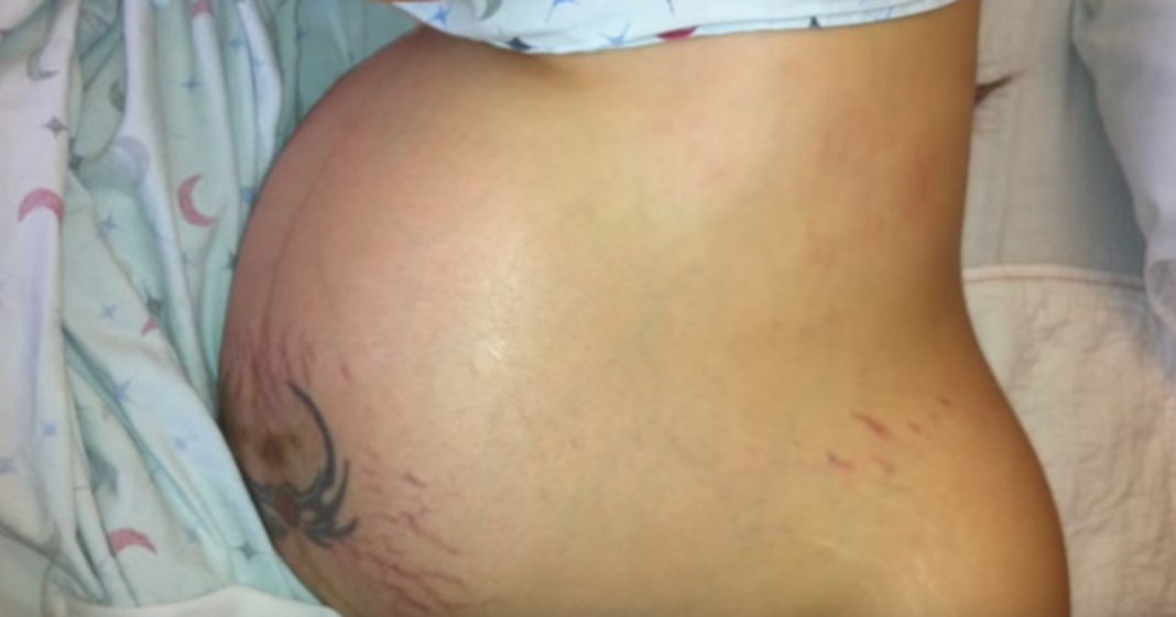 Mulher grávida de quatro bebés decide ir contra ao médico e levar a gravidez até ao fim