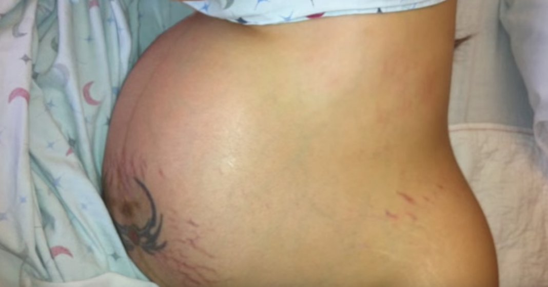 Mulher grávida de quatro bebés decide ir contra ao médico e levar a gravidez até ao fim