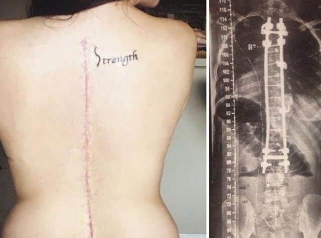 inspiringlife.pt - 19 tatuagens que serviram para disfarçar cicatrizes com histórias incríveis