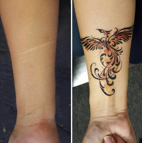 inspiringlife.pt - 19 tatuagens que serviram para disfarçar cicatrizes com histórias incríveis