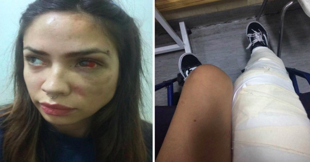 Jovem chilena faz publicação impressionante para alertar a sociedade para a violência doméstica