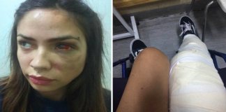 Jovem chilena faz publicação impressionante para alertar a sociedade para a violência doméstica