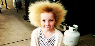 Menina sofre de raro síndrome que torna impossível pentear os cabelos