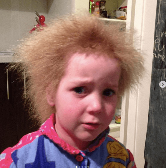 inspiringlife.pt - Menina sofre de raro síndrome que torna impossível pentear os cabelos
