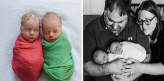 Sessão fotográfica de gémeos recém-nascidos emociona ao saber que um deles tem pouco tempo de vida