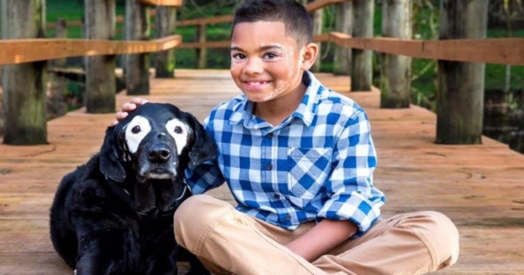 Menino aprende a gostar da sua doença com ajuda de cachorro que sofre do mesmo