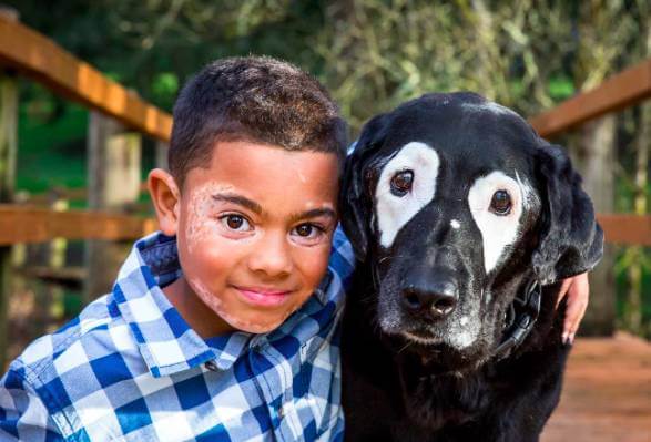 inspiringlife.pt - Menino aprende a gostar da sua doença com ajuda de cachorro que sofre do mesmo
