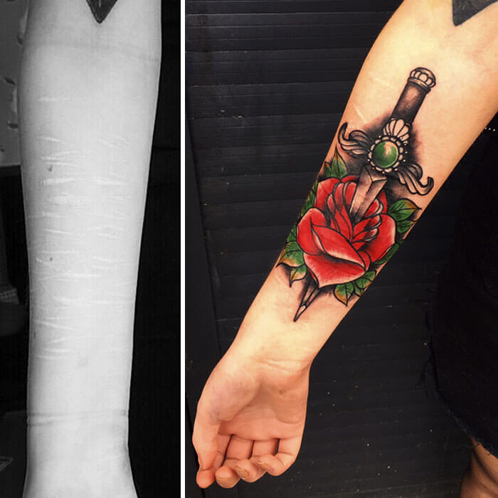 inspiringlife.pt - Tatuador oferece tatuagens gratuitas para quem quiser disfarçar cicatrizes auto-infligidas