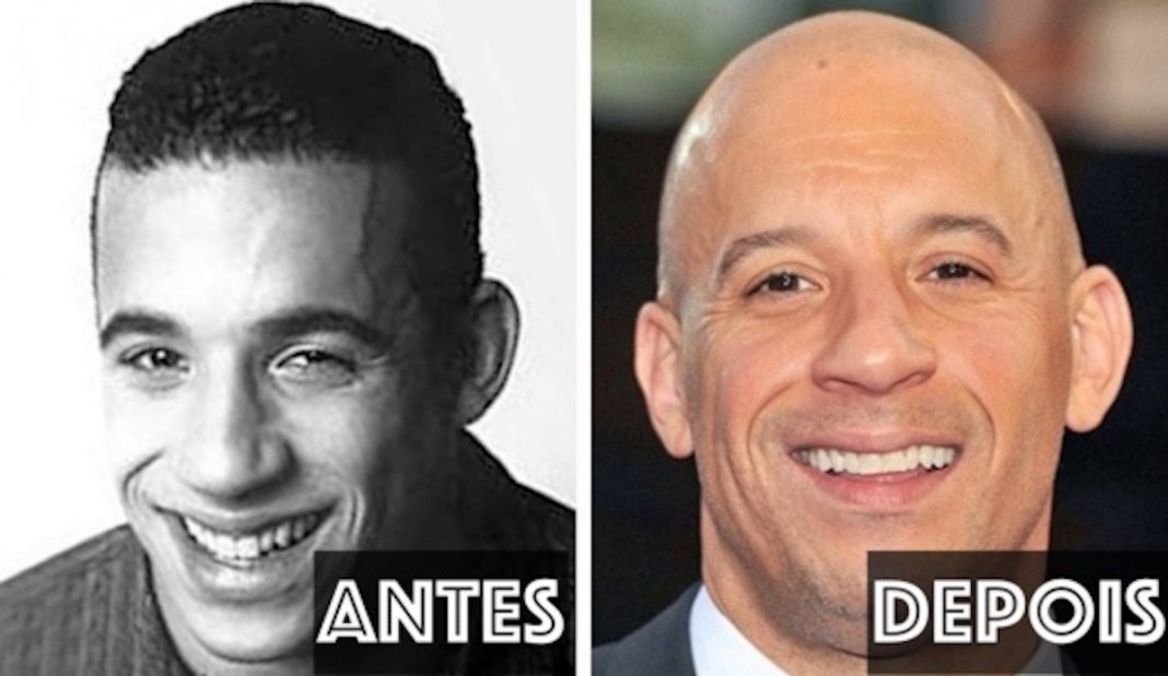 12 actores antes vs. depois de ficarem carecas