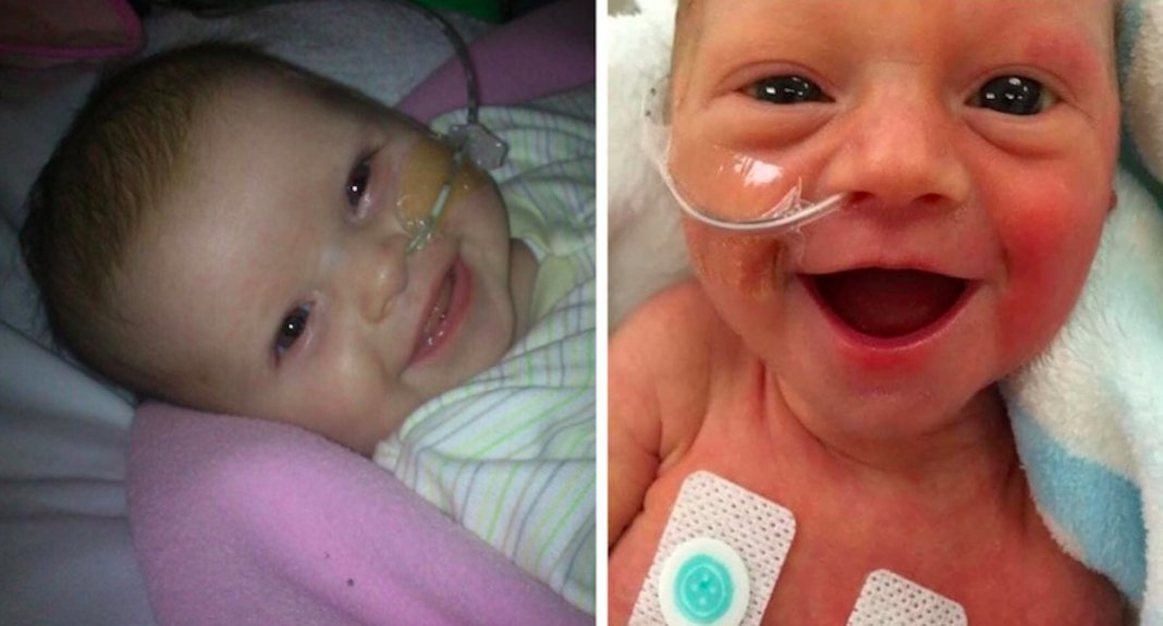9 adoráveis bebés prematuros a sorrir de felicidade por estarem vivos