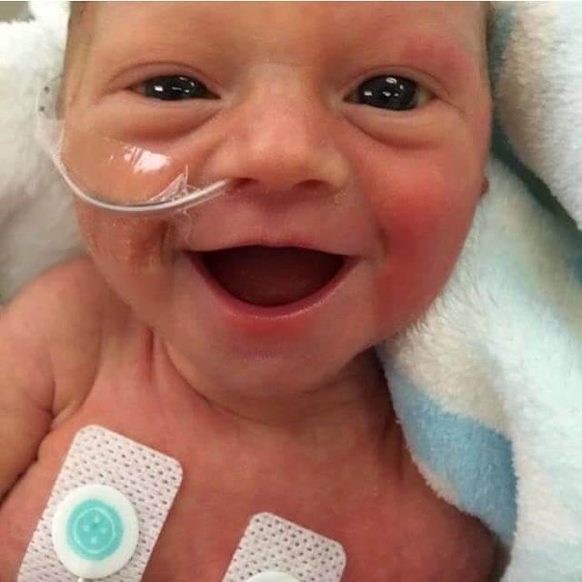 inspiringlife.pt - 9 adoráveis bebés prematuros a sorrir de felicidade por estarem vivos