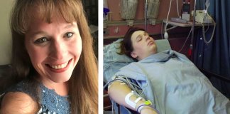 Mulher encontra agulha epidural “esquecida” na sua coluna 14 anos depois de dar à luz