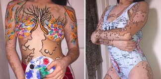 Jovem com vitiligo utiliza manchas do seu corpo para criar arte de forma fantástica