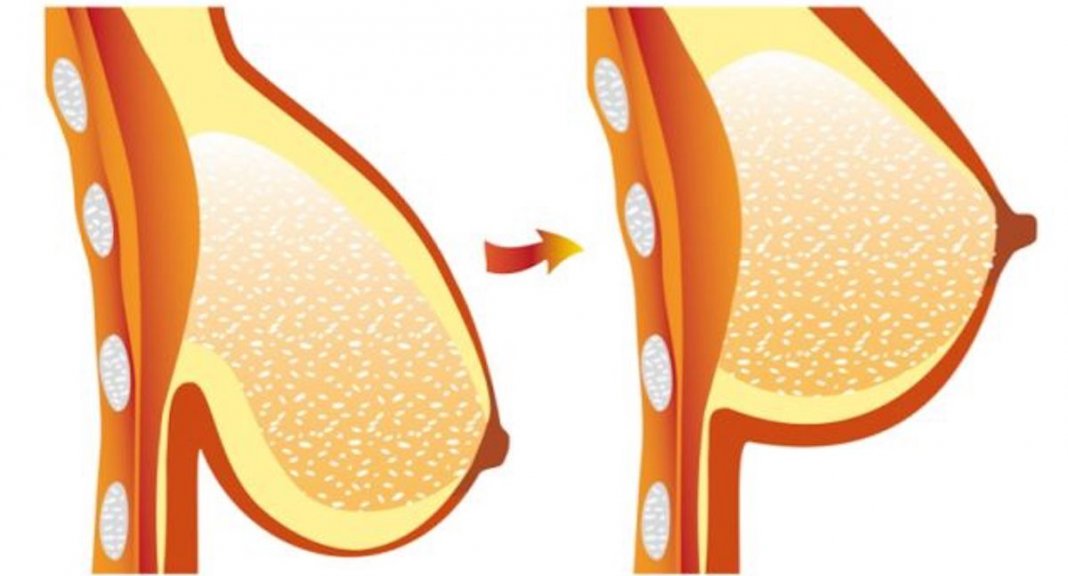 Receita caseira para recuperar a firmeza nos seios