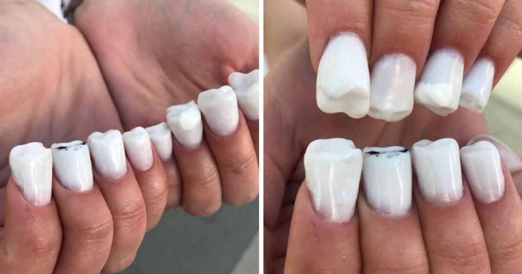 “Unhas molares” são a nova tendência nas unhas de gel e é absolutamente assustadora