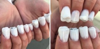 “Unhas molares” são a nova tendência nas unhas de gel e é absolutamente assustadora