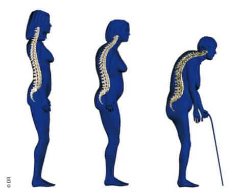 inspiringlife.pt - Corpo humano encolhe 1 cm a cada 10 anos a partir dos 30 anos de idade