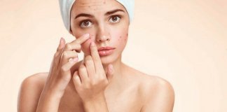 Estudo revela que acne na adolescência ajuda a ter uma pele mais jovem na idade adulta