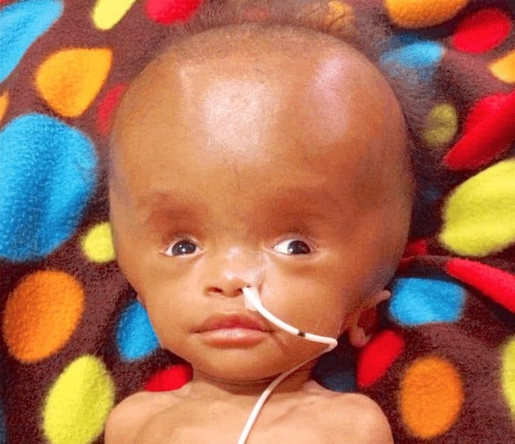 mulher-adopta-bebe-com-condicao-cerebral-especial-e-salva-a-de-um-fim-tragico2