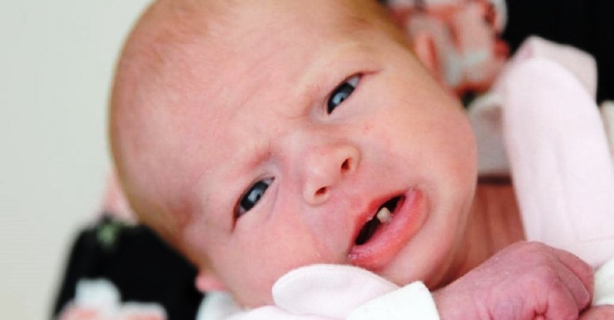 esta-bebe-nasceu-com-um-dente-deixando-tudo-e-todos-incredulos