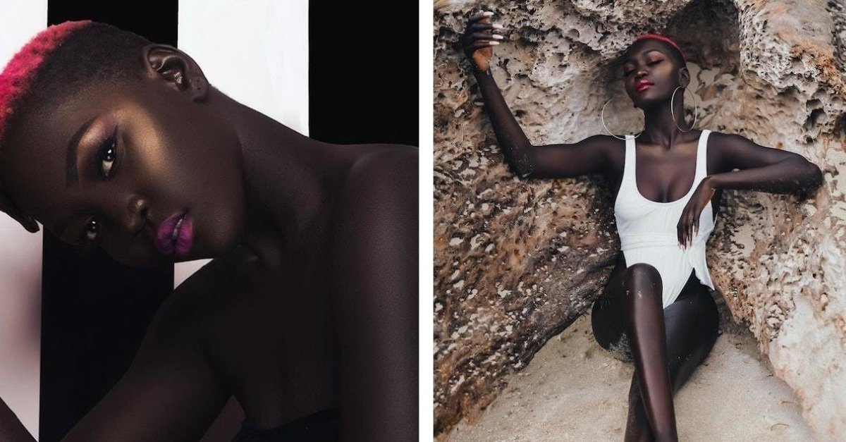modelo-africana-tentou-clarear-a-pele-com-lixivia-alvejante-e-conta-como-superou-o-preconceito