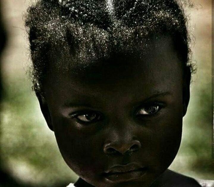 modelo-africana-tentou-clarear-a-pele-com-lixivia-alvejante-e-conta-como-superou-o-preconceito2