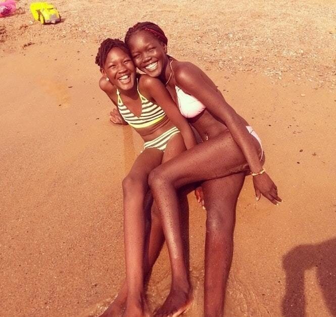 modelo-africana-tentou-clarear-a-pele-com-lixivia-alvejante-e-conta-como-superou-o-preconceito3