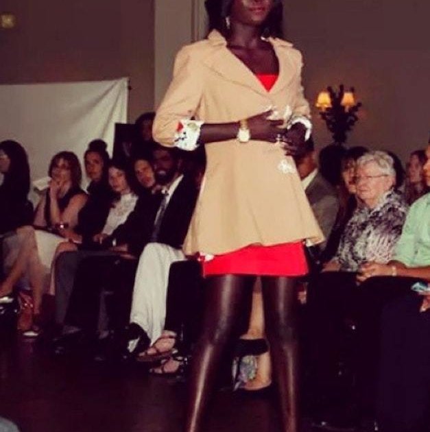 modelo-africana-tentou-clarear-a-pele-com-lixivia-alvejante-e-conta-como-superou-o-preconceito4