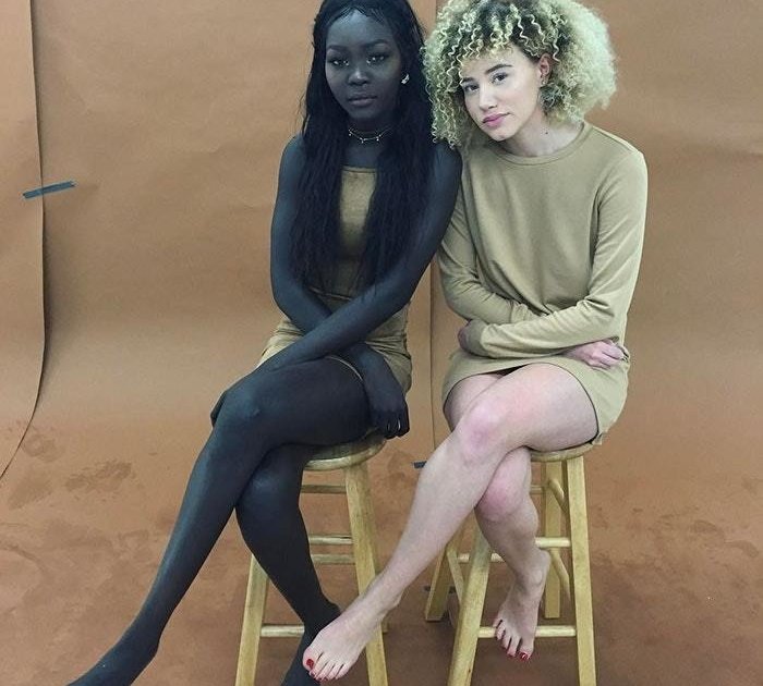 modelo-africana-tentou-clarear-a-pele-com-lixivia-alvejante-e-conta-como-superou-o-preconceito5