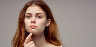 Quais as principais causas das borbulhas na cara?